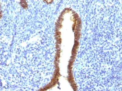 Formalin-fixed, paraffin-embedded human Uterus stained with ASRGL1 Monoclonal Antibody (CRASH/1289).