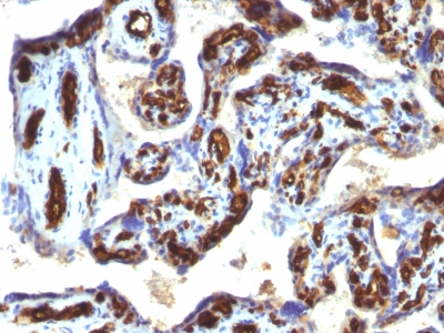 Formalin-fixed, paraffin-embedded human Placenta stained with CD34 Monoclonal Antibody (HPCA1/763)