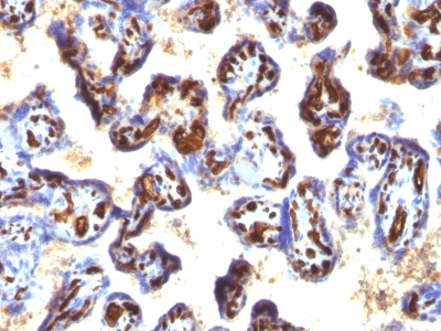 Formalin-fixed, paraffin-embedded human Placenta stained with CD34 Monoclonal Antibody (QBEnd/1 + HPCA1/763)