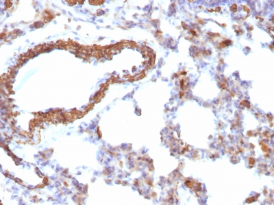 Formalin-fixed, paraffin-embedded Rat Lung stained with Muscle Specific Actin Monoclonal Antibody (MSA/953)