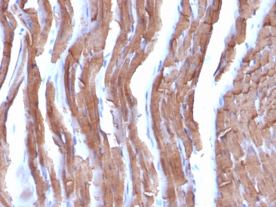Formalin-fixed, paraffin-embedded Rat Heart stained with Muscle Specific Actin Monoclonal Antibody (MSA/953)