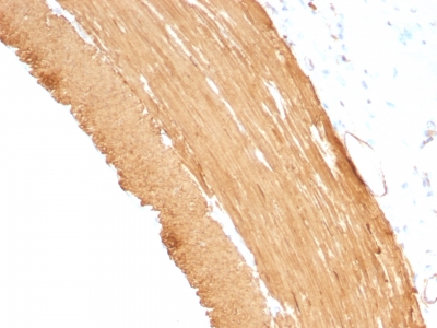 Formalin-fixed, paraffin-embedded Rat Stomach stained with Muscle Specific Actin Monoclonal Antibody (MSA/953)