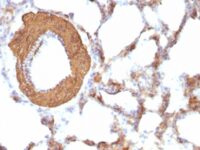 Formalin-fixed, paraffin-embedded Rat Lung stained with Muscle Specific Actin Monoclonal Antibody (HHF35 + MSA/953)