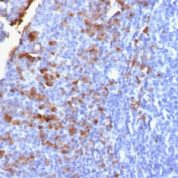 IgG Antibody staining (anti-human IgG) in human formalin fixed paraffin embedded tissue section from human tonsil.
