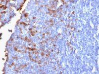 IgG Antibody staining (anti-human IgG) in human formalin fixed paraffin embedded tissue section from human tonsil.