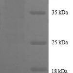 SDS-PAGE (reducing conditions) of recombinant human Cathepsin D (partial sequence) with N-terminal GST tag. Gel is Tris-Glycine with 5% loading gel on 15% separation gel.