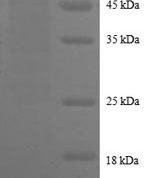 SDS-PAGE (reducing conditions) of recombinant human Cathepsin D (partial sequence) with N-terminal GST tag. Gel is Tris-Glycine with 5% loading gel on 15% separation gel.