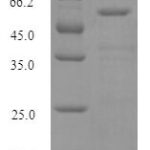 SDS-PAGE separation of QP10038 followed by commassie total protein stain results in a primary band consistent with reported data for Histidine--tRNA ligase