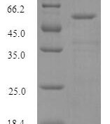 SDS-PAGE separation of QP10038 followed by commassie total protein stain results in a primary band consistent with reported data for Histidine--tRNA ligase