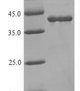 SDS-PAGE separation of QP10085 followed by commassie total protein stain results in a primary band consistent with reported data for Lutropin-choriogonadotropic hormone receptor. These data demonstrate Greater than 90% as determined by SDS-PAGE.