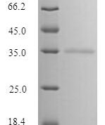 SDS-PAGE separation of QP10091 followed by commassie total protein stain results in a primary band consistent with reported data for Mannose-binding protein C. These data demonstrate Greater than 90% as determined by SDS-PAGE.