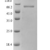 SDS-PAGE separation of QP10096 followed by commassie total protein stain results in a primary band consistent with reported data for Polypyrimidine tract-binding protein 1. These data demonstrate Greater than 90% as determined by SDS-PAGE.