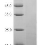 SDS-PAGE separation of QP10097 followed by commassie total protein stain results in a primary band consistent with reported data for Parathyroid Hormone. These data demonstrate Greater than 90% as determined by SDS-PAGE.