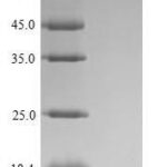 SDS-PAGE separation of QP10099 followed by commassie total protein stain results in a primary band consistent with reported data for Roundabout homolog 1. These data demonstrate Greater than 90% as determined by SDS-PAGE.