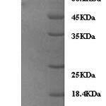 SDS-PAGE separation of QP10108 followed by commassie total protein stain results in a primary band consistent with reported data for Zyxin. These data demonstrate Greater than 90% as determined by SDS-PAGE.