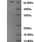 SDS-PAGE separation of QP10108 followed by commassie total protein stain results in a primary band consistent with reported data for Zyxin. These data demonstrate Greater than 90% as determined by SDS-PAGE.