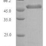 SDS-PAGE separation of QP10121 followed by commassie total protein stain results in a primary band consistent with reported data for PTX3 / Pentraxin 3 / TSG-14. These data demonstrate Greater than 90% as determined by SDS-PAGE.