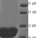 SDS-PAGE separation of QP1070 followed by commassie total protein stain results in a primary band consistent with reported data for FGF21 / Fibroblast Growth Factor 21. These data demonstrate Greater than 90% as determined by SDS-PAGE.