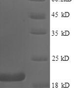 SDS-PAGE separation of QP1078 followed by commassie total protein stain results in a primary band consistent with reported data for Fragile histidine triad / FHIT. These data demonstrate Greater than 90% as determined by SDS-PAGE.