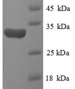 SDS-PAGE separation of QP1121 followed by commassie total protein stain results in a primary band consistent with reported data for HIF-1 alpha / HIF1A. These data demonstrate Greater than 90% as determined by SDS-PAGE.