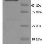 SDS-PAGE separation of QP1281 followed by commassie total protein stain results in a primary band consistent with reported data for PKLR / PKRL. These data demonstrate Greater than 90% as determined by SDS-PAGE.