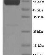 SDS-PAGE separation of QP1281 followed by commassie total protein stain results in a primary band consistent with reported data for PKLR / PKRL. These data demonstrate Greater than 90% as determined by SDS-PAGE.