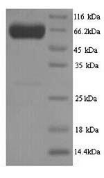 SDS-PAGE separation of QP1281 followed by commassie total protein stain results in a primary band consistent with reported data for PKLR / PKRL. These data demonstrate Greater than 90% as determined by SDS-PAGE.