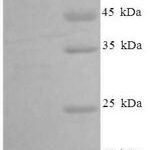 SDS-PAGE separation of QP1492 followed by commassie total protein stain results in a primary band consistent with reported data for MCP-3 / CCL7. These data demonstrate Greater than 90% as determined by SDS-PAGE.