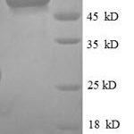 SDS-PAGE separation of QP2072 followed by commassie total protein stain results in a primary band consistent with reported data for CD14. These data demonstrate Greater than 90% as determined by SDS-PAGE.