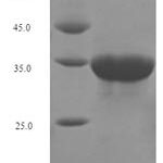 SDS-PAGE separation of QP2208 followed by commassie total protein stain results in a primary band consistent with reported data for CD8A / MAL. These data demonstrate Greater than 90% as determined by SDS-PAGE.