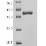 SDS-PAGE separation of QP5601 followed by commassie total protein stain results in a primary band consistent with reported data for Phosphatidylcholine translocator ABCB4. These data demonstrate Greater than 90% as determined by SDS-PAGE.