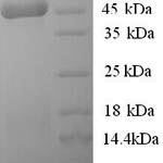 SDS-PAGE separation of QP5603 followed by commassie total protein stain results in a primary band consistent with reported data for 3-ketoacyl-CoA thiolase