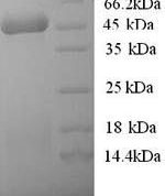 SDS-PAGE separation of QP5603 followed by commassie total protein stain results in a primary band consistent with reported data for 3-ketoacyl-CoA thiolase