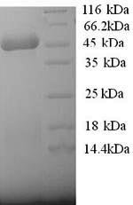 SDS-PAGE separation of QP5603 followed by commassie total protein stain results in a primary band consistent with reported data for 3-ketoacyl-CoA thiolase