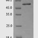 SDS-PAGE separation of QP5604 followed by commassie total protein stain results in a primary band consistent with reported data for Acetyl-CoA carboxylase 1. These data demonstrate Greater than 90% as determined by SDS-PAGE.