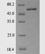 SDS-PAGE separation of QP5604 followed by commassie total protein stain results in a primary band consistent with reported data for Acetyl-CoA carboxylase 1. These data demonstrate Greater than 90% as determined by SDS-PAGE.