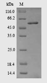 SDS-PAGE separation of QP5604 followed by commassie total protein stain results in a primary band consistent with reported data for Acetyl-CoA carboxylase 1. These data demonstrate Greater than 90% as determined by SDS-PAGE.