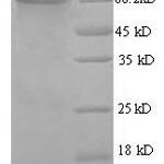 SDS-PAGE separation of QP5606 followed by commassie total protein stain results in a primary band consistent with reported data for Acetylcholinesterase / ACHE. These data demonstrate Greater than 90% as determined by SDS-PAGE.