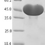 SDS-PAGE separation of QP5607 followed by commassie total protein stain results in a primary band consistent with reported data for ACLY / acly / ATP citrate lyase. These data demonstrate Greater than 90% as determined by SDS-PAGE.