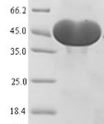 SDS-PAGE separation of QP5607 followed by commassie total protein stain results in a primary band consistent with reported data for ACLY / acly / ATP citrate lyase. These data demonstrate Greater than 90% as determined by SDS-PAGE.