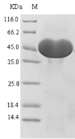 SDS-PAGE separation of QP5607 followed by commassie total protein stain results in a primary band consistent with reported data for ACLY / acly / ATP citrate lyase. These data demonstrate Greater than 90% as determined by SDS-PAGE.