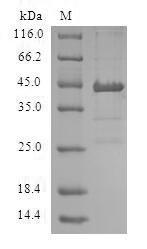 SDS-PAGE separation of QP5608 followed by commassie total protein stain results in a primary band consistent with reported data for ACP1 / LMW-PTP. These data demonstrate Greater than 80% as determined by SDS-PAGE.