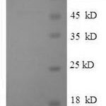 SDS-PAGE separation of QP5609 followed by commassie total protein stain results in a primary band consistent with reported data for SP-10 / ACRV1. These data demonstrate Greater than 90% as determined by SDS-PAGE.