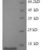 SDS-PAGE separation of QP5609 followed by commassie total protein stain results in a primary band consistent with reported data for SP-10 / ACRV1. These data demonstrate Greater than 90% as determined by SDS-PAGE.