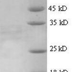 SDS-PAGE separation of QP5619 followed by commassie total protein stain results in a primary band consistent with reported data for AFP / alpha-fetoprotein. These data demonstrate Greater than 90% as determined by SDS-PAGE.