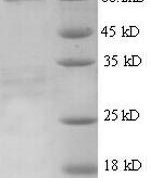 SDS-PAGE separation of QP5619 followed by commassie total protein stain results in a primary band consistent with reported data for AFP / alpha-fetoprotein. These data demonstrate Greater than 90% as determined by SDS-PAGE.
