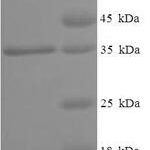 SDS-PAGE separation of QP5620 followed by commassie total protein stain results in a primary band consistent with reported data for AGA / ASRG / Aspartylglucosaminidase. These data demonstrate Greater than 90% as determined by SDS-PAGE.