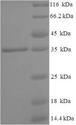 SDS-PAGE separation of QP5620 followed by commassie total protein stain results in a primary band consistent with reported data for AGA / ASRG / Aspartylglucosaminidase. These data demonstrate Greater than 90% as determined by SDS-PAGE.