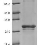 SDS-PAGE separation of QP5621 followed by commassie total protein stain results in a primary band consistent with reported data for AGA / ASRG / Aspartylglucosaminidase. These data demonstrate Greater than 90% as determined by SDS-PAGE.