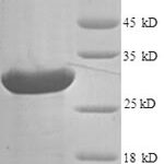 SDS-PAGE separation of QP5623 followed by commassie total protein stain results in a primary band consistent with reported data for AGRP. These data demonstrate Greater than 90% as determined by SDS-PAGE.